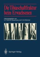 Die Tibiaschaftfraktur beim Erwachsenen edito da Springer Berlin Heidelberg