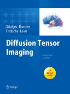 Diffusion Tensor Imaging di Bram Stieltjes, Romuald M. Brunner, Klaus Fritzsche, Frederik B. Laun edito da Springer-verlag Berlin And Heidelberg Gmbh & Co. Kg