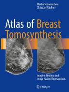 Atlas of Breast Tomosynthesis di Martin Sonnenschein, Christian Waldherr edito da Springer-Verlag GmbH