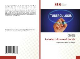 La tuberculose multifocale di Amal Chakroun, Fatma Smaoui, Makram Koubaa edito da Éditions universitaires européennes