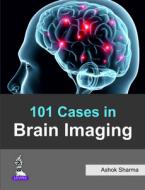 101 Cases in Brain Imaging di Ashok Sharma edito da Jaypee Brothers Medical Publishers
