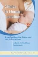 Breastfeeding After Breast And Nipple Procedures di Diana West, Elliot M. Hirsch edito da Hale Publishing