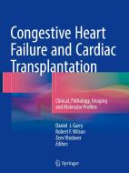 Congestive Heart Failure and Cardiac Transplantation edito da Springer-Verlag GmbH