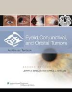 Eyelid, Conjunctival, And Orbital Tumors di Jerry A. Shields, Dr. Carol L. Shields edito da Lippincott Williams And Wilkins