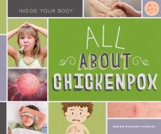 All about Chickenpox di Megan Borgert-Spaniol edito da SUPER SANDCASTLE