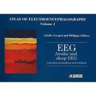 Atlas Of Electroencephalography di Arielle Crespel, Philippe Gelisse edito da John Libbey Eurotext