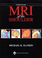 Mri Of The Shoulder di Michael B. Zlatkin edito da Lippincott Williams And Wilkins