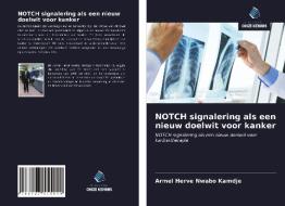 NOTCH signalering als een nieuw doelwit voor kanker di Armel Herve Nwabo Kamdje edito da Uitgeverij Onze Kennis