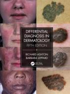 Differential Diagnosis In Dermatology di Richard Ashton, Barbara Leppard edito da Taylor & Francis Ltd