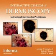 Interactive Cd-rom Of Dermoscopy di Ashfaq A. Marghoob, Ralph P. Braun, Alfred W. Kopf edito da Taylor & Francis Ltd