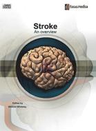 Stroke: An Overview edito da Mercury Learning & Information
