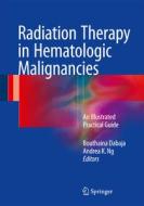 Radiation Therapy in Hematologic Malignancies edito da Springer-Verlag GmbH