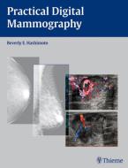 Practical Digital Mammography di Beverly Hashimoto edito da Thieme Publishers New York