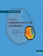 Toole's Cerebrovascular Disorders di Dr. E. Steve Roach, Kerstin Bettermann, Dr. Jose Biller edito da Cambridge University Press