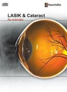 Lasik and Cataract: An Overview edito da Mercury Learning & Information