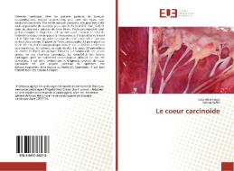 Le coeur carcinoide di Leila Abid Trigui, Rahma Kallel edito da Éditions universitaires européennes