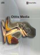 Otitis Media: An Overview edito da Mercury Learning & Information