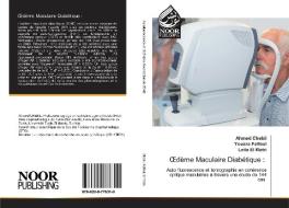 OEdème Maculaire Diabétique : di Ahmed Chebil, Yousra Falfoul, Leila El Matri edito da Noor Publishing