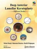Deep Anterior Lamellar Keratoplasty Different Strokes edito da Jaypee Brothers Medical Publishers