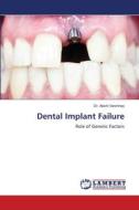 Dental Implant Failure di Akshi Varshney edito da LAP LAMBERT Academic Publishing