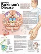 Understanding Parkinson's Disease Anatomical Chart edito da Lippincott Williams And Wilkins