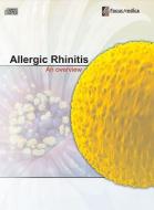 Allergic Rhinitis: An Overview edito da Mercury Learning & Information