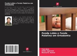 Fenda Lábio e Fenda Palatina em Ortodontia di Fyjo Jose, Ankur Agarwal, Reena R. Kumar edito da Edições Nosso Conhecimento