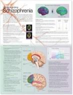 Understanding Schizophrenia Anatomical Chart edito da Lippincott Williams And Wilkins