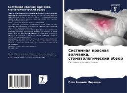 Sistemnaq krasnaq wolchanka, stomatologicheskij obzor di Otto Alemán Miranda edito da Sciencia Scripts