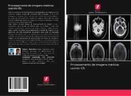 Processamento de imagens médicas usando IDL di Rathan Natarajan, Sunilkumar Gopakumar edito da Edições Nosso Conhecimento