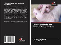 Coinvolgimento del piede nella gonartrosi di Kaouther Maatallah, Mariem Hfaïdh edito da Edizioni Sapienza