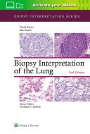 Biopsy Interpretation Of The Lung di Saul Suster, David Suster edito da Wolters Kluwer Health