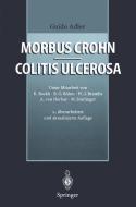 Morbus Crohn - Colitis ulcerosa di Guido Adler edito da Springer Berlin Heidelberg