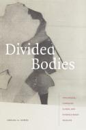 Divided Bodies: Lyme Disease, Contested Illness, and Evidence-Based Medicine di Abigail A. Dumes edito da DUKE UNIV PR