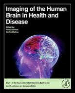 Imaging of the Human Brain in Health and Disease edito da ACADEMIC PR INC