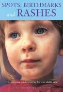 Spots, Birthmarks and Rashes: The Complete Guide to Caring for Your Child's Skin di June thompson edito da Firefly Books