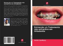 Extracção v/s Tratamento não extractivo em Ortodontia di Sachin Upadhyay edito da Edições Nosso Conhecimento