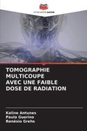TOMOGRAPHIE MULTICOUPE AVEC UNE FAIBLE DOSE DE RADIATION di Kaline Antunes, Paula Guerino, Renésio Grehs edito da Editions Notre Savoir