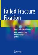 Failed Fracture Fixation edito da Springer International Publishing