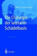 Die Chirurgie Der Lateralen Schadelbasis edito da Springer