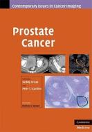 Prostate Cancer di Hedvig Hricak edito da Cambridge University Press