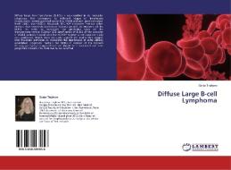 Diffuse Large B-cell Lymphoma di Sanja Trajkova edito da LAP Lambert Academic Publishing