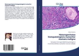 Heterogenitatea histopatologica a tumorilor mamare maligne di Adrian Dumitru edito da GlobeEdit