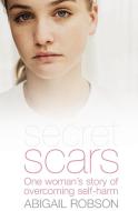Secret Scars di Abigail Robson edito da Authentic