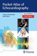 Pocket Atlas of Echocardiography di Thomas Böhmeke, Ralf Doliva edito da Thieme Georg Verlag