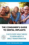 The Consumer's Guide To Dental Implants: di D.D.S. WILLIAMS edito da Lightning Source Uk Ltd