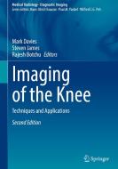 Imaging of the Knee edito da Springer International Publishing