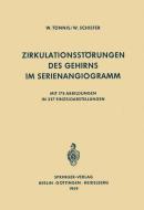 Zirkulationsstörungen des Gehirns im Serienangiogramm di W. Schiefer, W. Tönnis edito da Springer Berlin Heidelberg