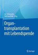 Organtransplantation mit Lebendspende edito da Springer-Verlag GmbH