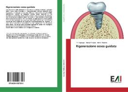 Rigenerazione ossea guidata di Eiti Agrawal, Rahul Chopra, Nikhil Sharma edito da Edizioni Accademiche Italiane